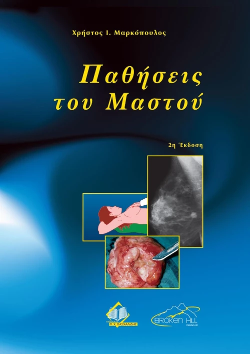 Παθήσεις του Μαστού, 2η Έκδοση