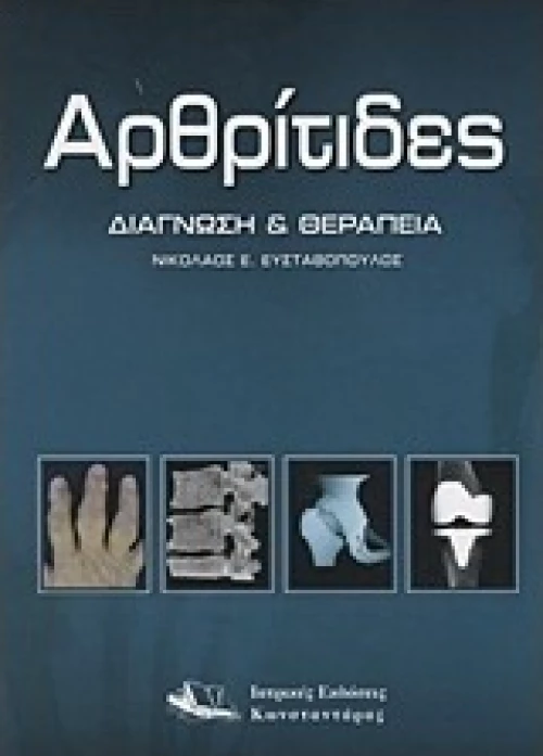 Αρθρίτιδες, Διάγνωση και θεραπεία