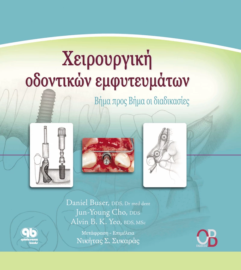 Χειρουργική οδοντικών εμφυτευμάτων, Βήμα προς βήμα οι διαδικασίες