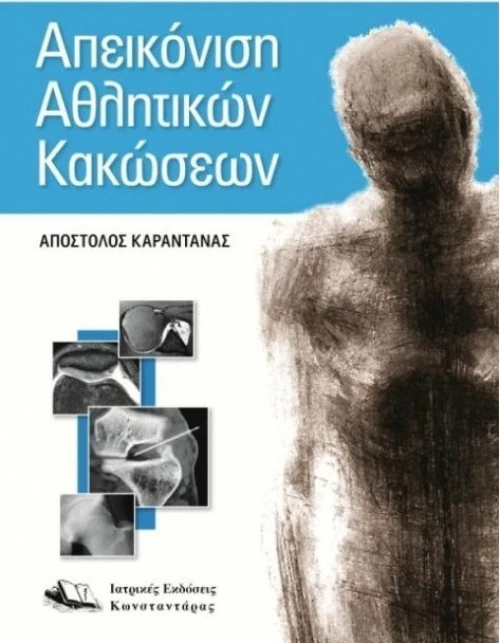 Απεικόνιση αθλητικών κακώσεων