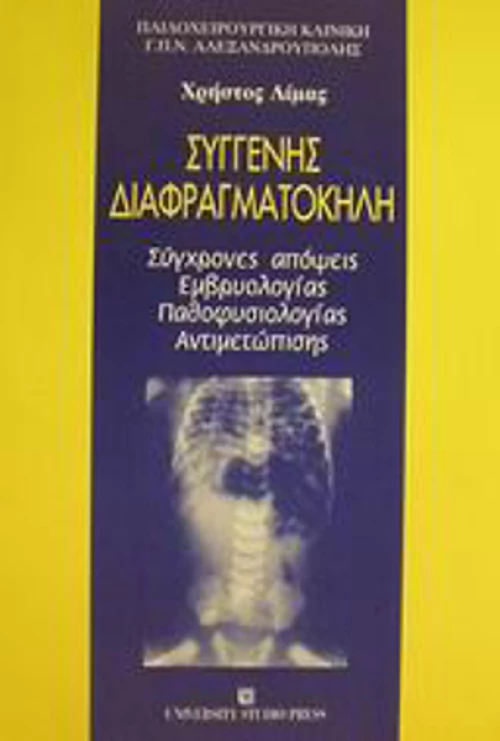 Συγγενής διαφραγματοκήλη