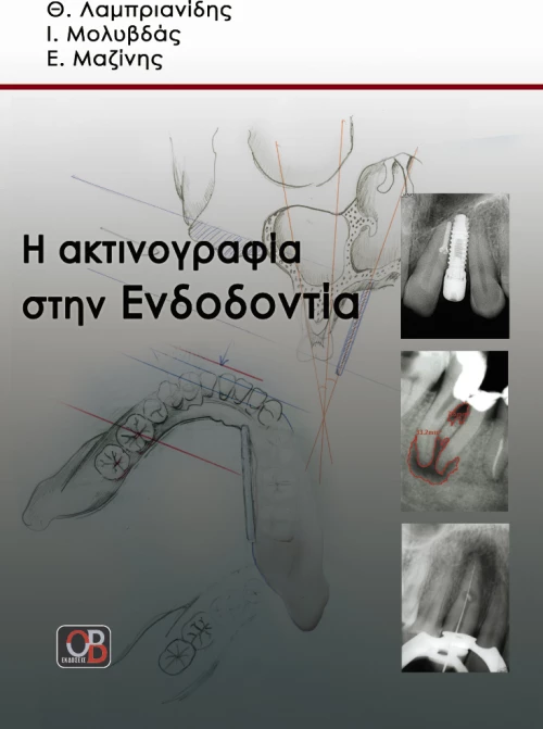 Η ακτινογραφία στην ενδοδοντία