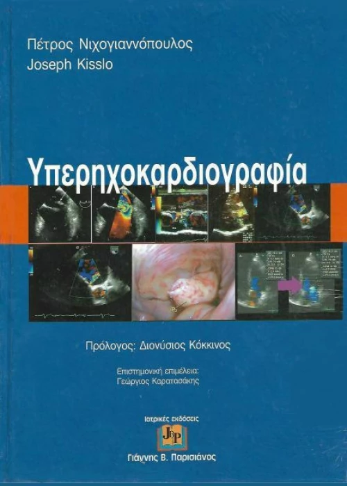 Υπερηχοκαρδιογραφία