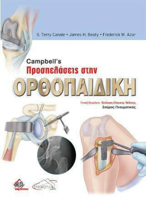 Campbells Προσπελάσεις στην Ορθοπαιδική