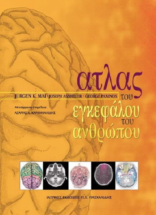 Άτλας του εγκεφάλου του ανθρώπου