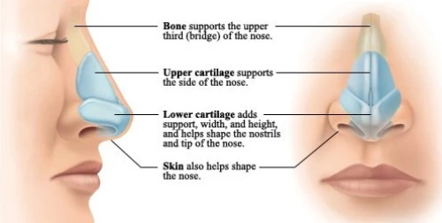 Συσκευή σηκώματος διόρθωσης  μύτης
