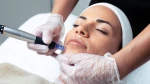 Microneedling Fractional RF – Σύσφιξη & Αναζωογόνηση σε Βάθος