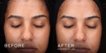 Medik8 Press & Glow 200ml